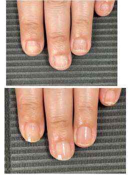 ルカロンネイル(Rukaron Nail)/2枚爪