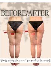 エイエービジュー(Aa.bijou)/50代　女性