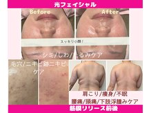 CBDサロン ローズ(ROSE)