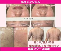 CBDサロン ローズ(ROSE)
