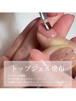 トップジェルを塗布