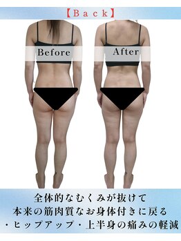 トゥジュール バイ ボウケンフライ(toujours by Bokenfly)/【痩身】【痩せたい】【むくみ】