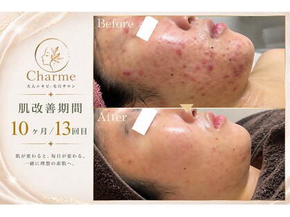シャルム(Charme.)の写真