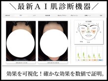 韓国肌管理室 ソア(soa)の雰囲気(最新肌診断機♪肉眼で見えない肌トラブルを精密に可視化)