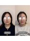 リスタット 市原(Restat)の写真/鏡を見るたびが、楽しみになる。フェイスラインすっきり小顔矯正☆
