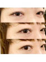 コレット 関目店(colette.)/上下つけ放題コース