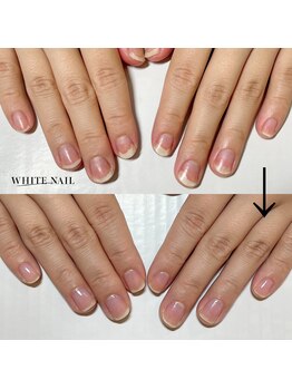 ホワイトネイル 武蔵小杉店(WHITE NAIL)/ネイルケア・自爪育成・爪育