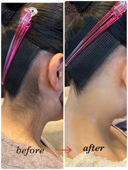 キ カエラ(Ki caera)/脱毛前にプロの襟足シェービング