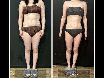 グラシアス サロン(GRACIAS SALON)/人気NO1ガッツリ痩身エステ