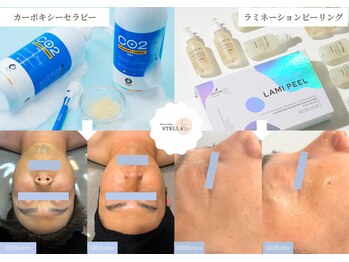 ステラ(STELLA)