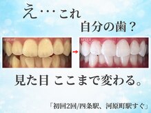 ホワイトニングショップ 四条店