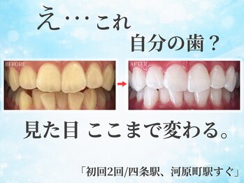 ホワイトニングショップ 四条店