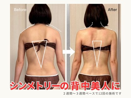 ミービレイ(Mie美戻)の写真