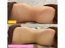 Beauty Salon Leyra【バストアップ/痩身/小顔/筋膜リリース】【4/22 NEWOPEN(予定)】/