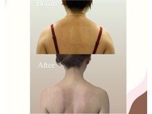 エステ大阪PONの雰囲気（[痩身]むくみ改善☆お顔とのセットで効果up◎）