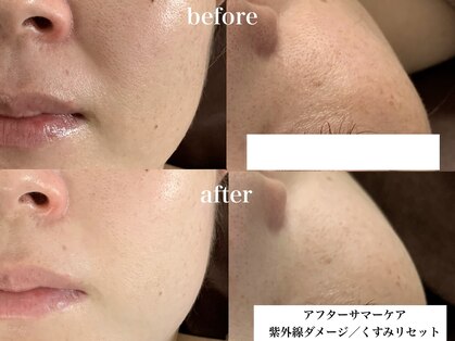 ルネ(Lune)の写真