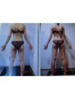 パーフェクトボディプレミアム 渋谷店(PERFECT BODY PREMIUM)/お客様 ビフォーアフター(23)