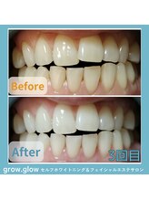 グロウ グロウ(grow.glow)/