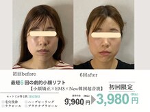 初回だけでもOK！しつこい勧誘無し！最短６回ではっきりわかる変化！