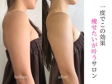 グラッソ(GRASSO)の雰囲気（気になる箇所・お悩みに合わせて対応◎【ダイエット/痩身】）