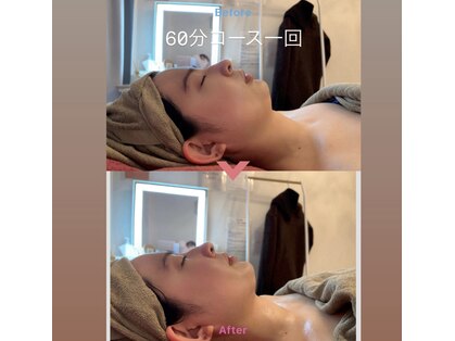 インディバ 恵比寿(INDIBA)の写真