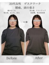 シナジェ 並木通り店(Synergye)/雰囲気まで変わる施術です☆彡