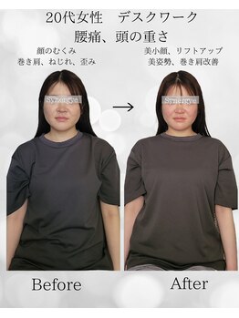 シナジェ 並木通り店(Synergye)/雰囲気まで変わる施術です☆彡