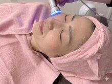 レモンローズ(Lemon Rose)の雰囲気（たるみ・むくみ　肌改善と引き締め！リーズナブルに肌管理を）