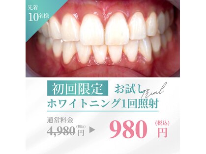 ホワイトベース(White base)の写真