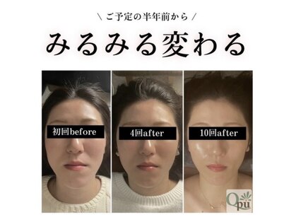 キュープ 福岡大牟田店(Qpu)の写真