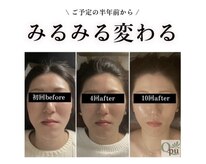 キュープ 福岡大牟田店(Qpu)