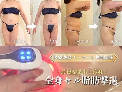 マノマノ エミュー(manomano emu)の写真