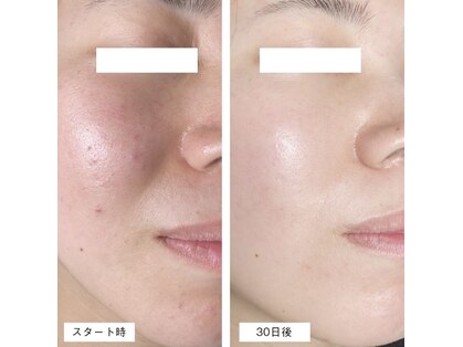 エキュレ ジャーニー トゥ マイ トータル ビューティー(equrer)の写真