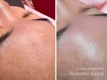 レネットサロン(Reinette Salon)