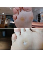 爪切り屋 足楽/タコの奥に魚の目