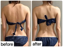 メロウ(me: llow)/恵比寿/ハイパーナイフEX