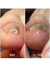 アモット(Amout)/