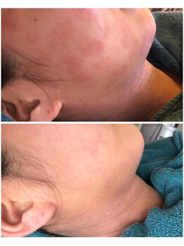 ココオーブ(COCO AUBE)/敏感なゆらぎ肌