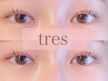 トレス(tres)の写真
