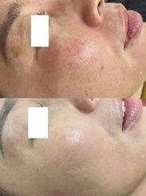 イーズン(Easen)/