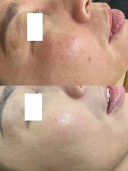 イーズン(Easen)/