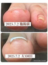 ブロックファイブハナ(Block 5 HANA)/