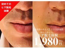 メンズ エステティック ヒーロー(men's esthetic HERO)