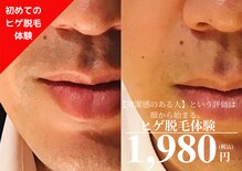メンズ エステティック ヒーロー(men's esthetic HERO)