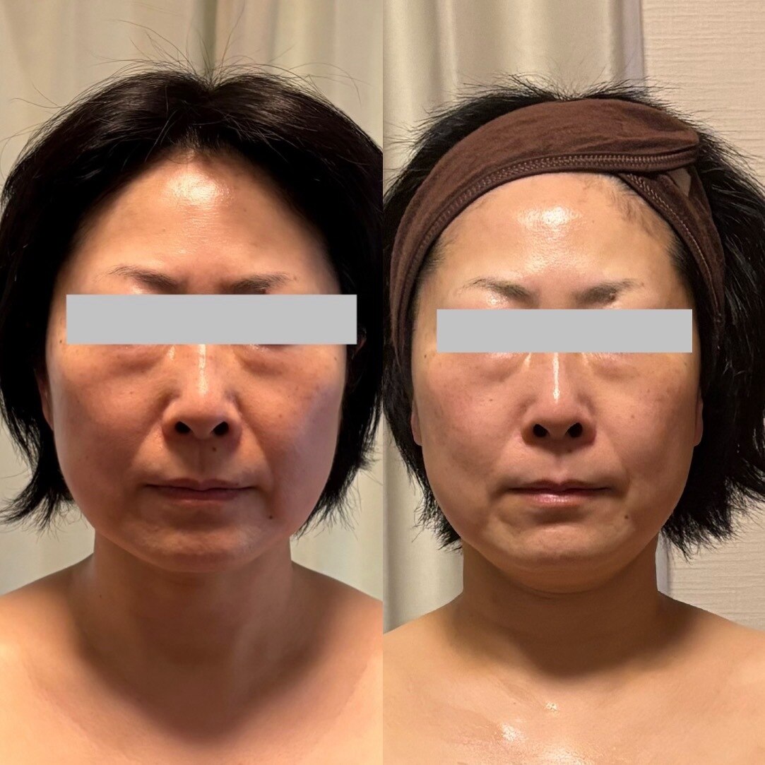 ニコ(NIKO)｜ホットペッパービューティー