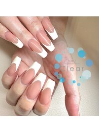 美爪矯正ジェルフレンチネイル