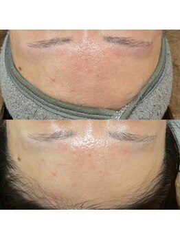 シエル 美里店(ciel)/フェイシャル