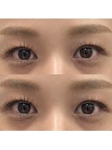 アルフォンス バイ ブリッジ(Alphonse by Bridge)/《コーティングなし》