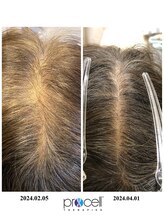 ヒルナム(Heal Nam)/プロセルセラピーズ　~頭皮~