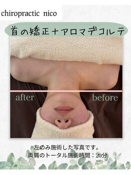 カイロプラクティック ニコ(nico)/アロマデコルテマッサージ